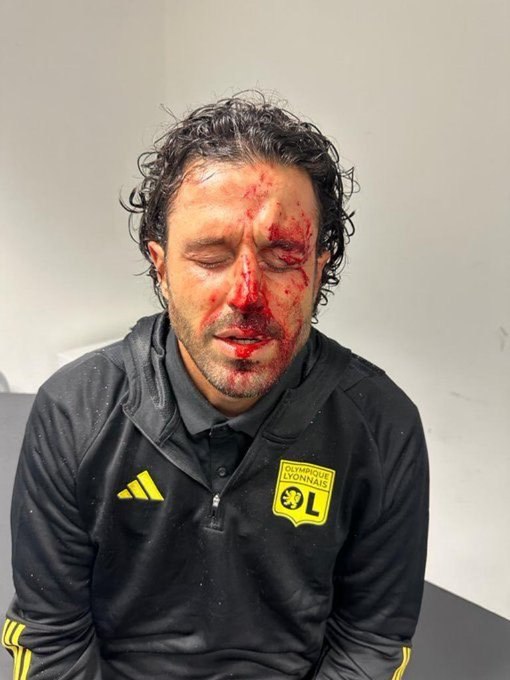 Meciul din Campionatul Franței dintre Marsilia și Lyon a fost anulat din cauza violențelor FOTO+VIDEO